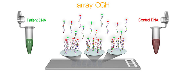 array CGH